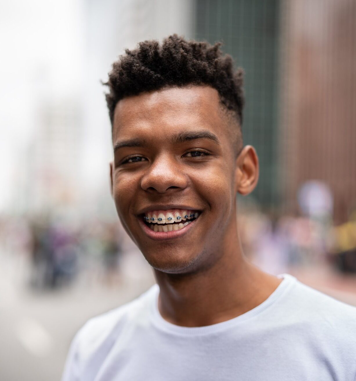 Metal Braces in Duncanville & Grand Prairie, TX